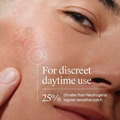 Neutrogena Sensitive Skin Patch Minis - 36ct: Anti-Acne, Fragrance-Free, Facial Treatment