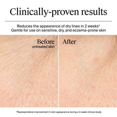 Neutrogena Hydro Boost Water Gel Cream Face Moisturizer with Hyaluronic Acid for Normal to Dry Skin - Fragrance Free - 0.5 fl oz