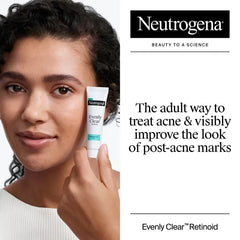 Neutrogena Evenly Clear Retinoid Acne Treatment Adapalene Gel 0.1% - 0.5 fl oz: For Face, Oily Skin, Unscented