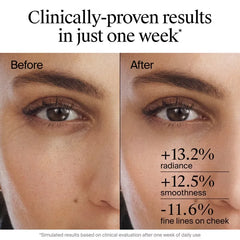 Neutrogena Rapid Wrinkle Repair Retinol Renewal Serum - 1 fl oz: For Mature Skin, Face & Neck Use, Contains Retinol, Unscented